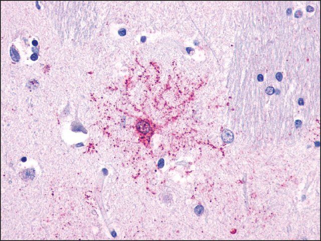 Anti-NTSR2 antibody produced in rabbit