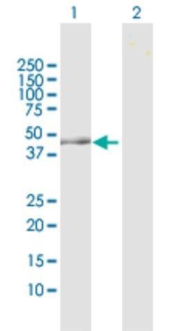 Anti-OAT antibody produced in rabbit