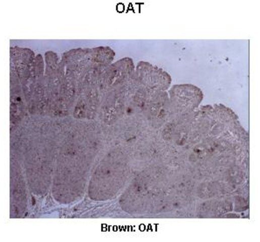 Anti-OAT antibody produced in rabbit