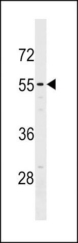 ANTI-NT5D2 (CENTER) antibody produced in rabbit