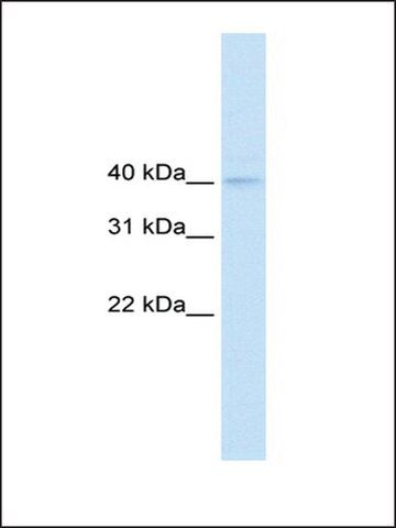 Anti-NUDT9 (AB2) antibody produced in rabbit