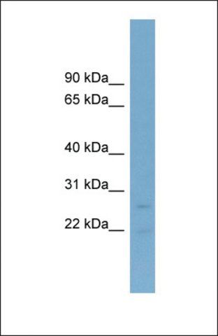 Anti-NT5M antibody produced in rabbit