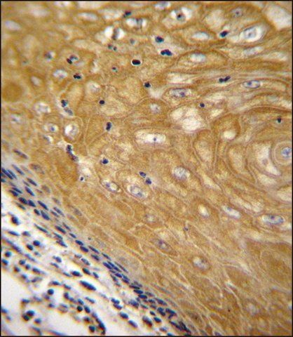 ANTI-NUDT22 (C-TERM) antibody produced in rabbit