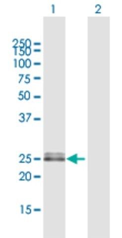 Anti-OIP5 antibody produced in rabbit