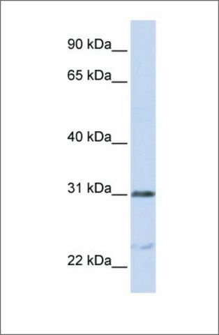 Anti-NUSAP1 antibody produced in rabbit