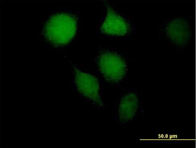 Anti-OGG1 antibody produced in mouse