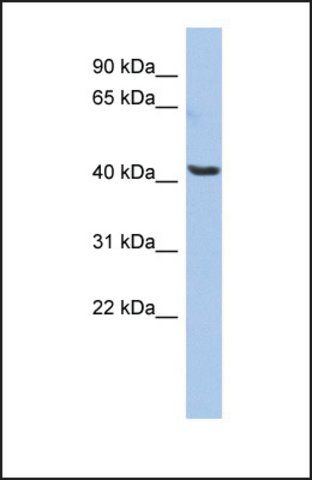 Anti-OLFML1 antibody produced in rabbit