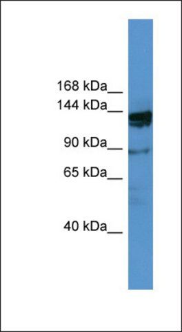 Anti-OGDHL antibody produced in rabbit