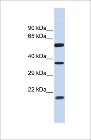 Anti-NT5DC1 antibody produced in rabbit