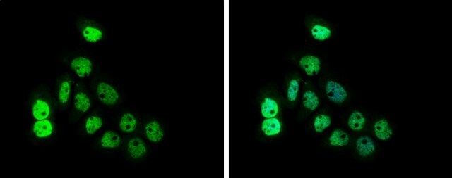 Anti-NUF2 antibody produced in rabbit