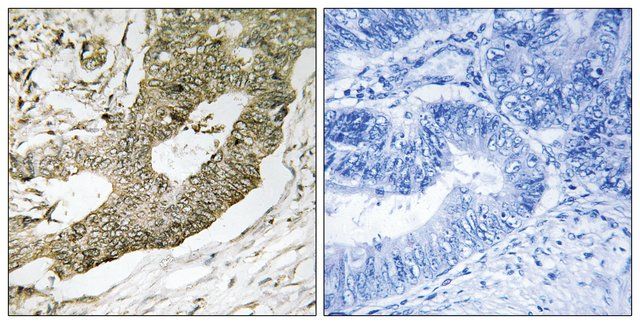 Anti-NUCKS1 antibody produced in rabbit