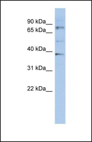 Anti-OAS2 antibody produced in rabbit