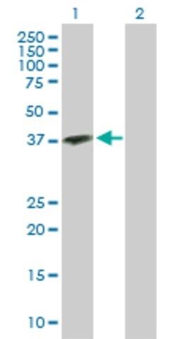 Anti-OGN antibody produced in rabbit