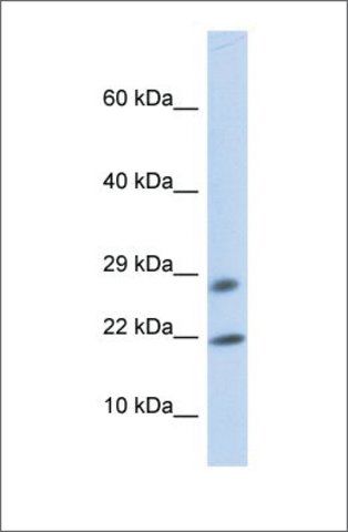 Anti-OCIAD2 antibody produced in rabbit