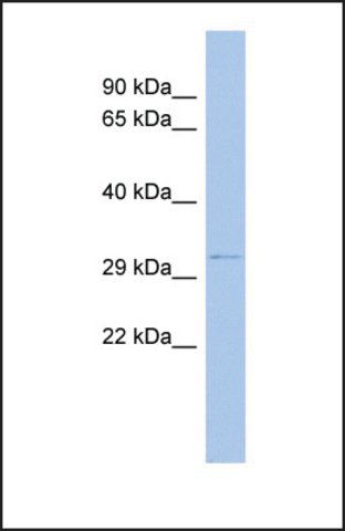 Anti-ODF4, (N-terminal) antibody produced in rabbit