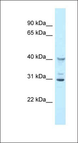 Anti-OAS1G antibody produced in rabbit