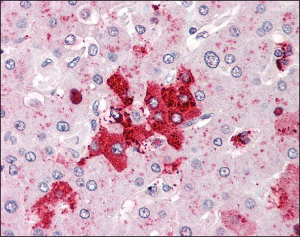 Anti-OLFM4 antibody produced in rabbit