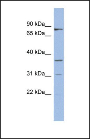 Anti-OLAH, (N-terminal) antibody produced in rabbit