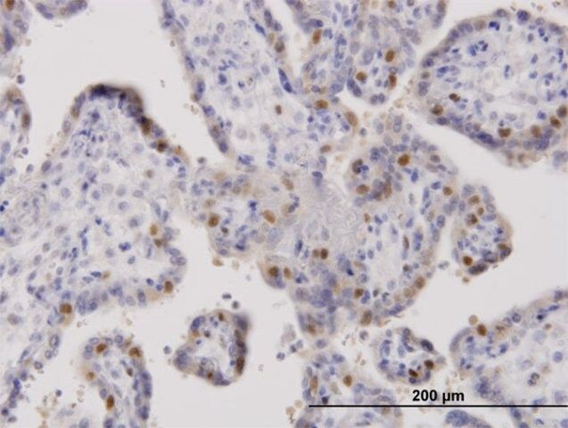 Anti-ORC6L antibody produced in mouse