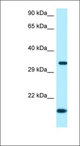 Anti-ORC5 antibody produced in rabbit