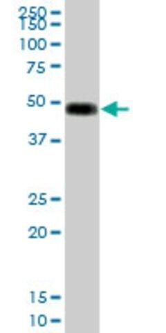 Anti-ORM1 antibody produced in mouse