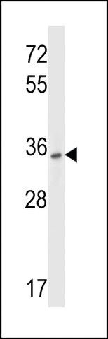 ANTI-P2RY10 (CENTER) antibody produced in rabbit