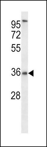 ANTI-P2RY6 (C-TERM) antibody produced in rabbit