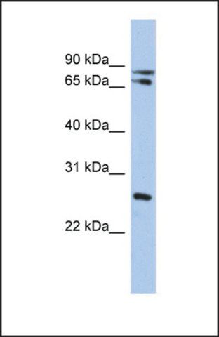 Anti-OVOL2 antibody produced in rabbit