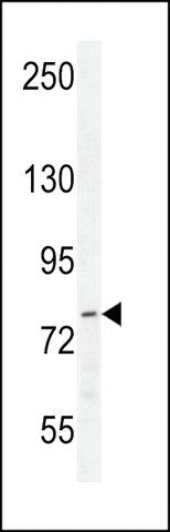 ANTI-P21WAF1 (CENTER H450) antibody produced in rabbit