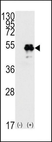 ANTI-P53 (T55) antibody produced in rabbit