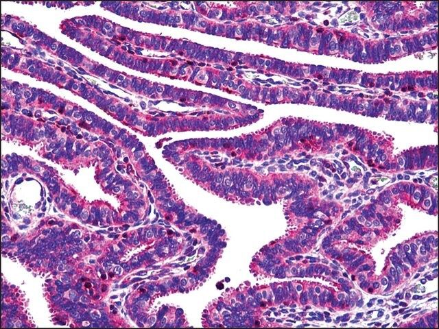 Anti-OVGP1 antibody produced in rabbit