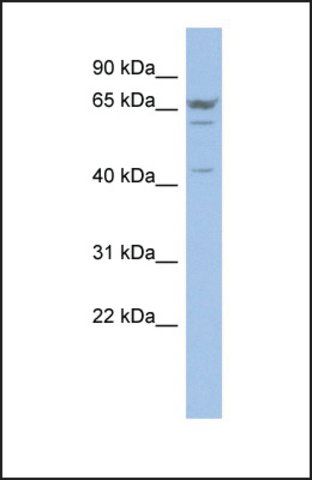 Anti-P2RX2, (N-terminal) antibody produced in rabbit