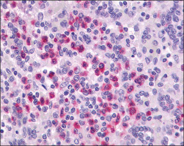 Anti-P2RY4 / P2Y4 antibody produced in rabbit