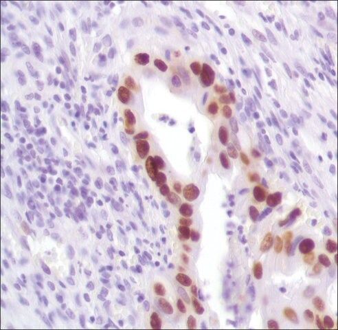 Anti-P53 antibody, Rabbit monoclonal