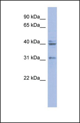 Anti-PABPN1, (N-terminal) antibody produced in rabbit