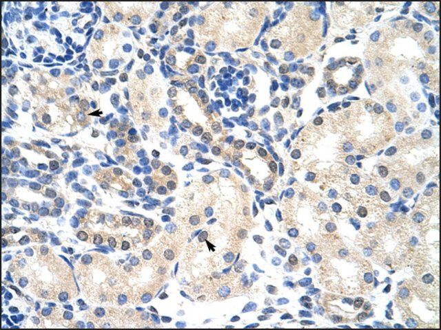 Anti-PABPC4 antibody produced in rabbit