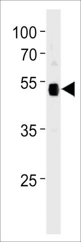 ANTI-P53 (SUMOYLATION SITE SPECIFIC) antibody produced in rabbit