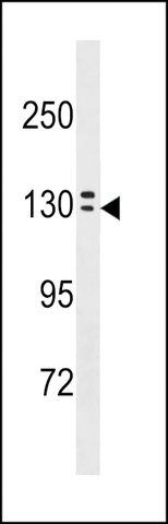 ANTI-OVCH1 (N-TERM) antibody produced in rabbit