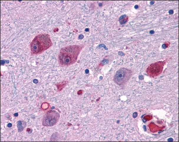 Anti-P2RY14 / P2Y14 antibody produced in rabbit