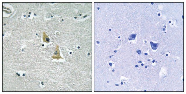 Anti-p47 PHOX, C-Terminal antibody produced in rabbit