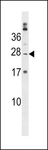 ANTI-PABPC1L2B(C-TERMINAL) antibody produced in rabbit