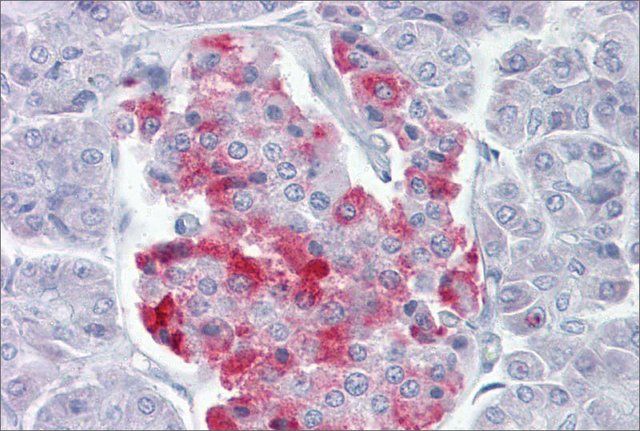 Anti-PCSK1 antibody produced in rabbit