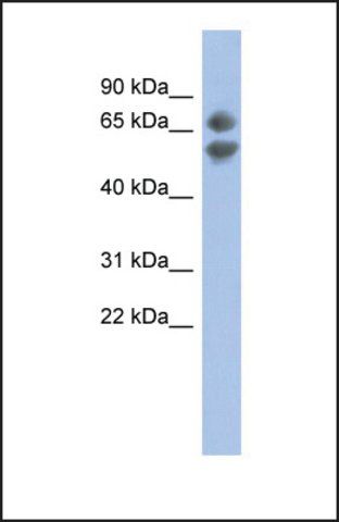 Anti-PDCD7 antibody produced in rabbit