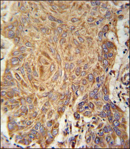 ANTI-PCYXL (C-TERM) antibody produced in rabbit