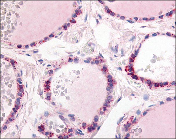 Anti-PDE1C antibody produced in rabbit