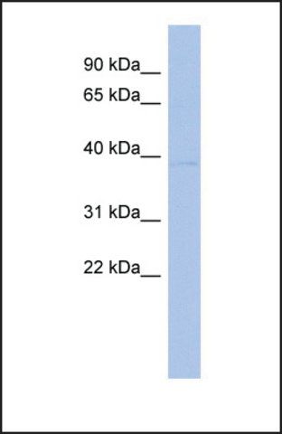 Anti-PDGFD, (N-terminal) antibody produced in rabbit