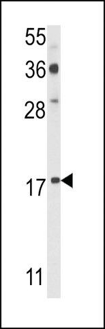 ANTI-PDRG(N-TERMINAL) antibody produced in rabbit