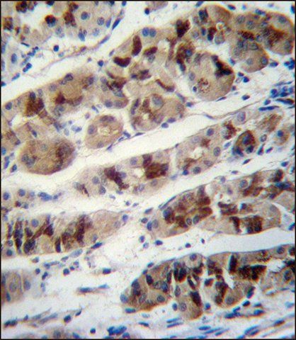 ANTI-PCIA1 (CENTER) antibody produced in rabbit