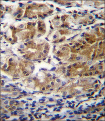 ANTI-PDPR (C-TERM) antibody produced in rabbit