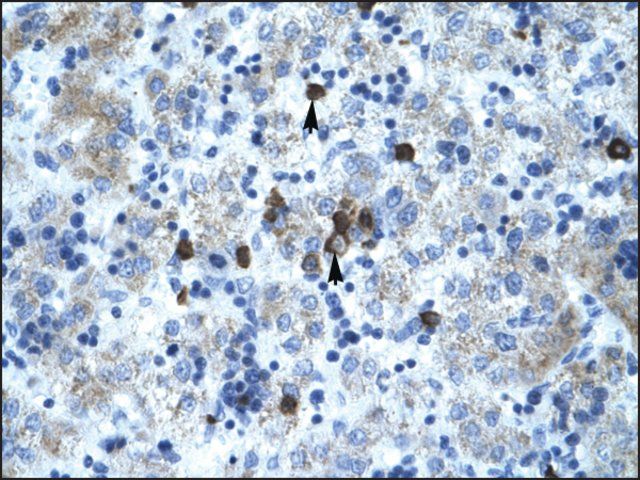 Anti-PCYOX1 antibody produced in rabbit